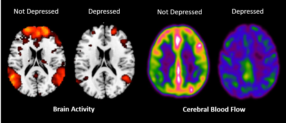cog-figure-2---cognition-and-mental-health