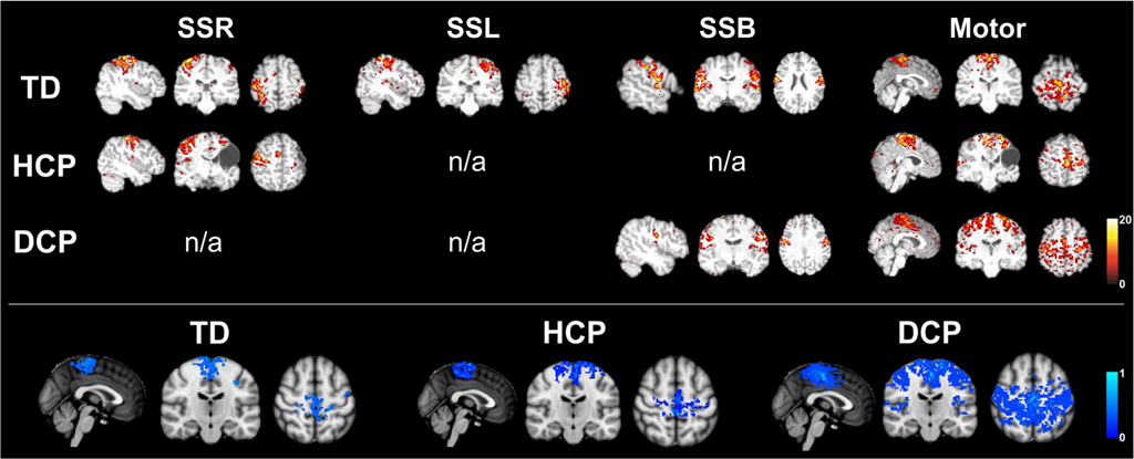 meg-fig2-movementdis