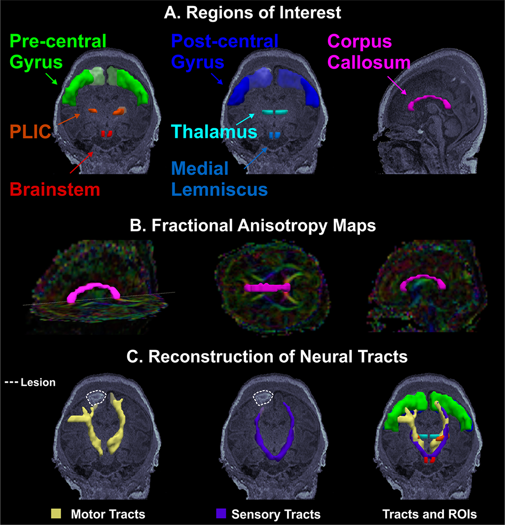neo-fig-2---first-image