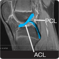 cond-acl
